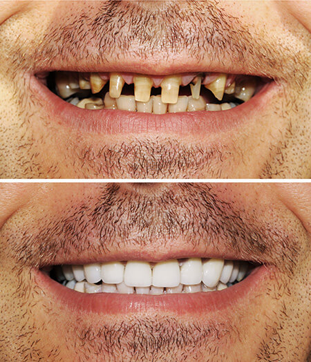 Lambourne Family Dental perfect teeth 02