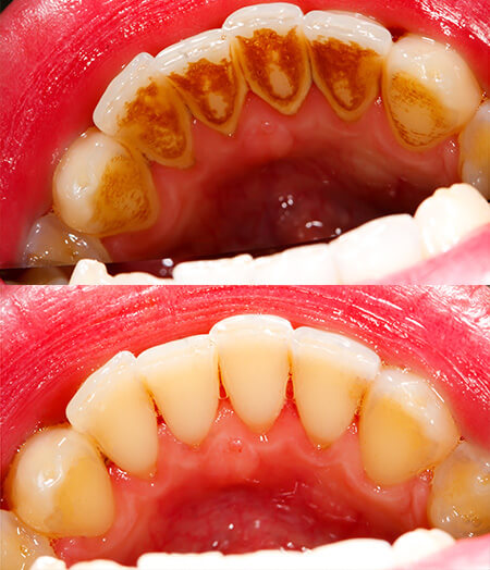 Lambourne Family Dental perfect teeth 03