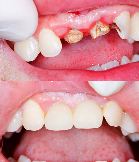 Lambourne Family Dental perfect teeth 04