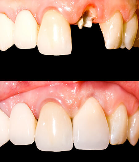 Lambourne Family Dental perfect teeth 05