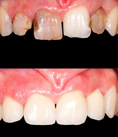 Lambourne Family Dental perfect teeth 06