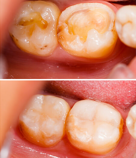 Lambourne Family Dental perfect teeth 07