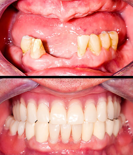 Lambourne Family Dental perfect teeth 08