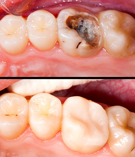 Lambourne Family Dental perfect teeth 09