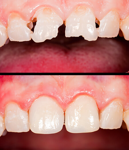 Lambourne Family Dental perfect teeth 10