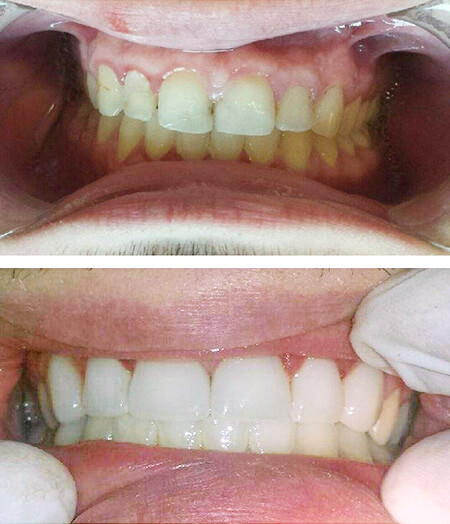Lambourne Family Dental perfect teeth 11
