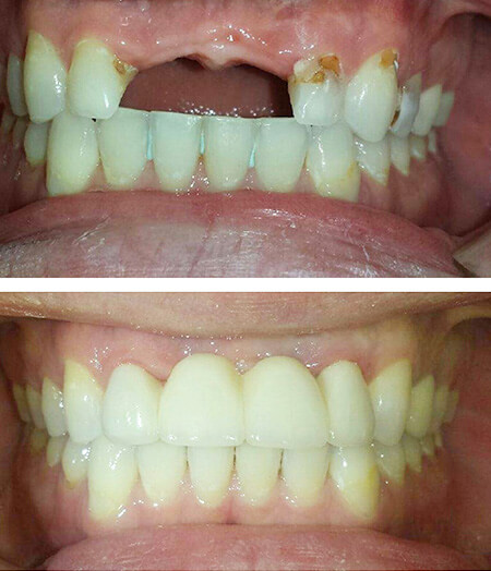 Lambourne Family Dental perfect teeth 12